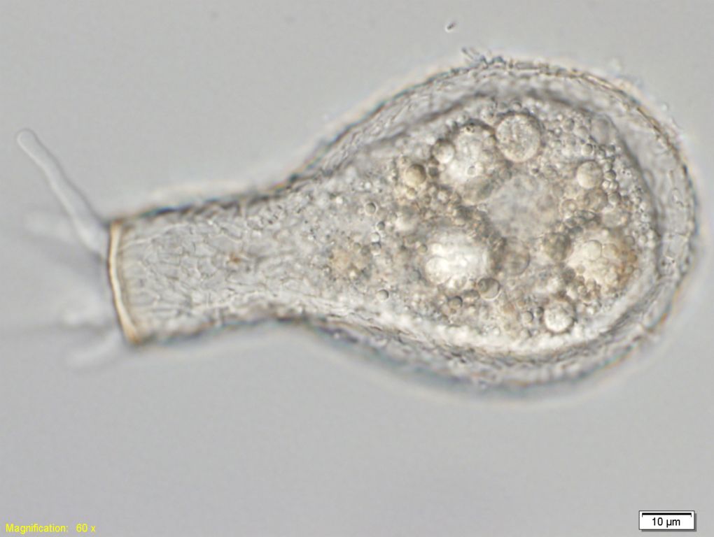 A live Padaungiella lageniformis, with pseudopods extending from the aperture to the left. Daniel J. G. Lahr