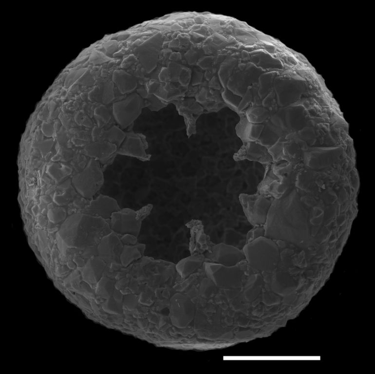 A scanning electron micrograph of a Cyclopyxis lobostoma shell, bottom view. Anush Kosakyan