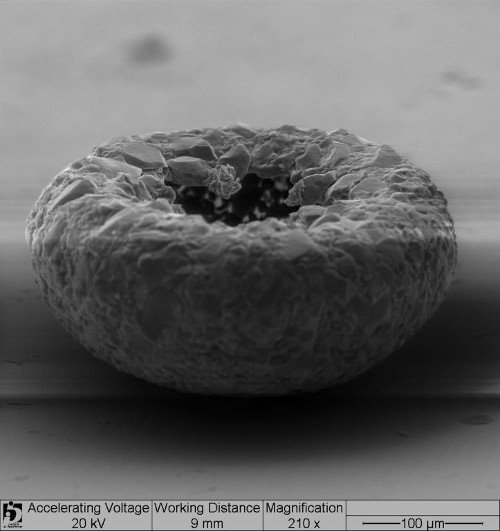 A scanning electron micrograph of a Cyclopyxis lobostoma shell, side view, the aperture is facing up. Anush Kosakyan