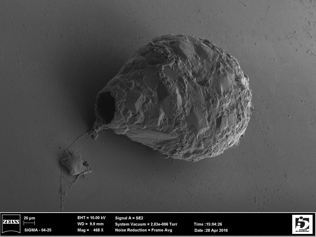 A scanning electron micrograph of a Difflugia compressashell, side view, the aperture is facing left. Anush Kosakyan