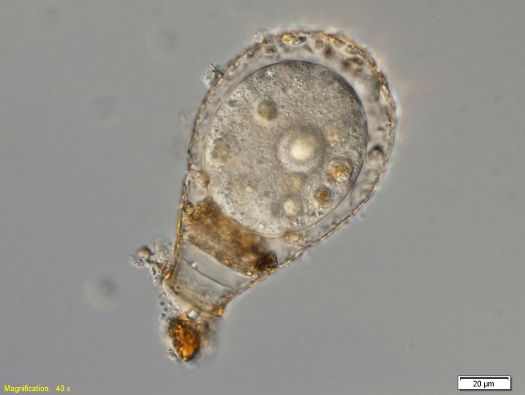 A live cell of Porosia bigibbosa, with pseudopods retracted. Daniel J. G. Lahr